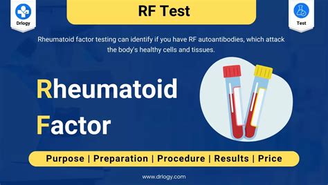 what is a good rf reading|Rheumatoid Factor: What It Is, Test Details & Normal Range.